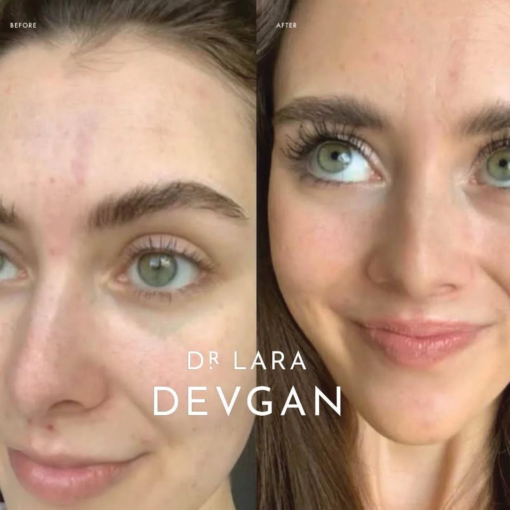 DR DEVGAN PLATINUM LONG LASH SERUM SCIENTIFIC BEAUTY VEGAN BEST MOST RESULTS NWT - Picture 11 of 14